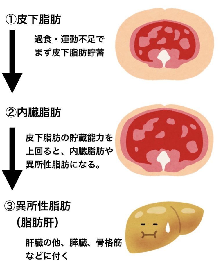 内臓脂肪と炎症が関係?(ファスティング実践記録) 医師が教える分子栄養学体質改善.lab 内臓脂肪と炎症が関係?(ファスティング実践記録) 医師が教える分子栄養学体質改善.lab
